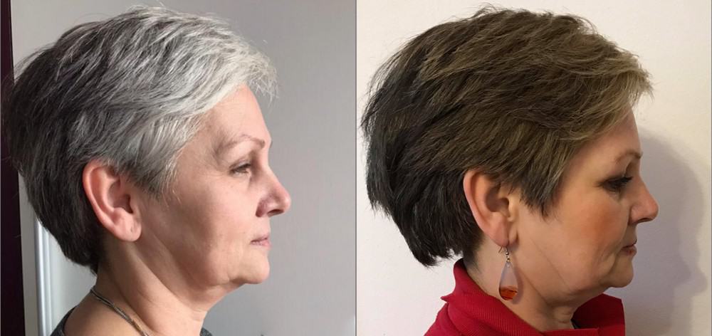 dyeing grey hair? Use GR-7 Professional instead. The anti grey hair product effectiveness shown on before and after photos