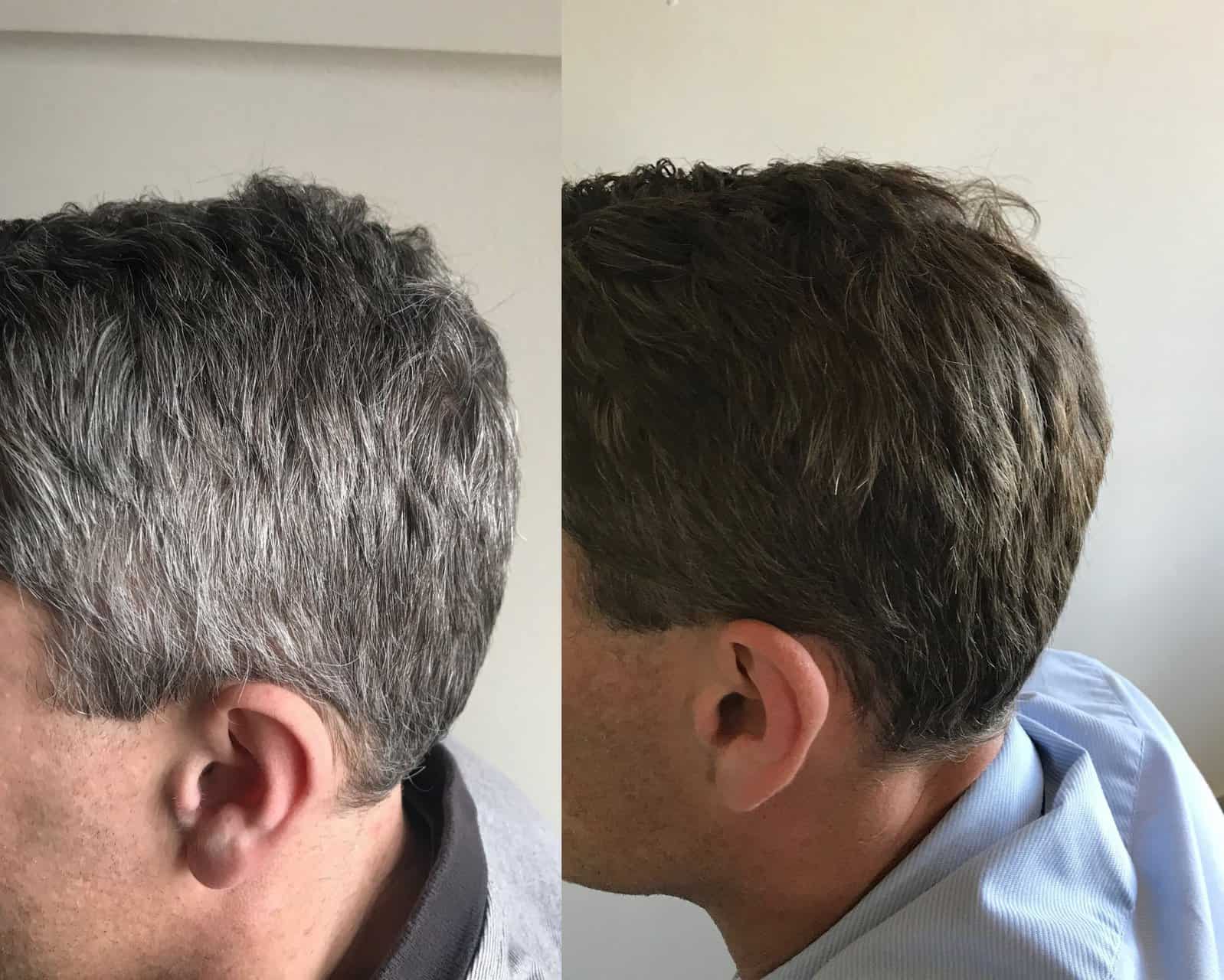 Grey hair at a young age – what to do? GR-7 Professional is the answer!