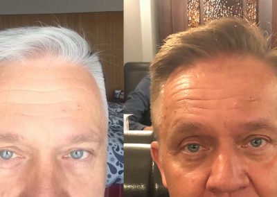 GR-7 anti grey hair product effectiveness shown on before and after photos