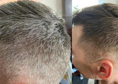 GR-7 anti grey hair product effectiveness shown on before and after photos