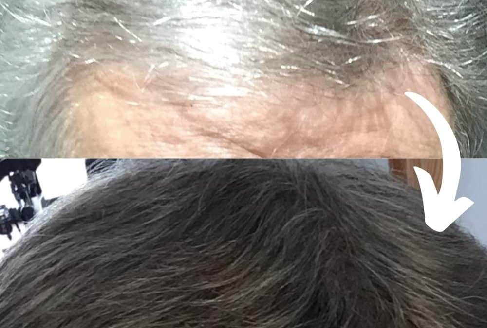 Greying hair – a problem that can be solved in a natural way!